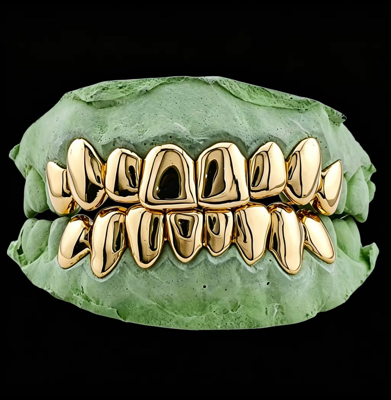Aleación de Oro No Preciosa (NPG) ($35 por Diente)