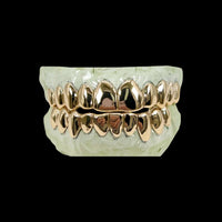 Grillz de oro de 14 quilates (285 $ por diente)