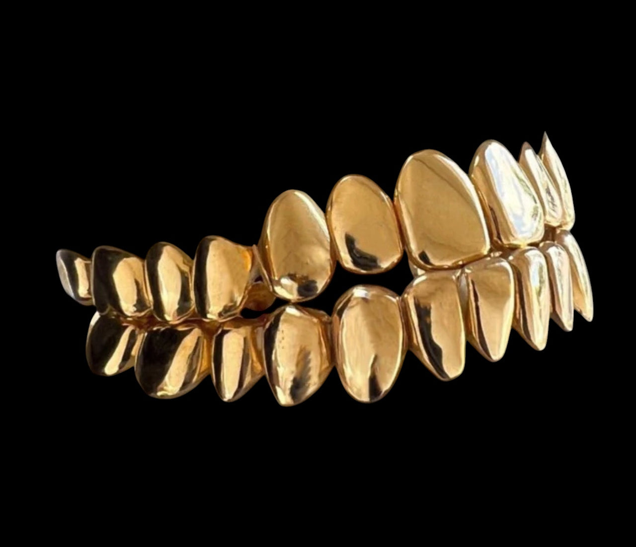 Grillz de oro de 18 quilates (370 $ por diente)