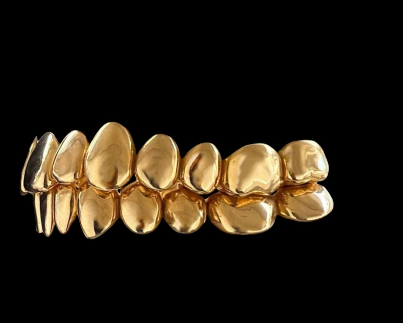 Grillz de oro de 18 quilates (370 $ por diente)